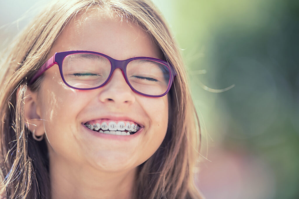 smile makeovers in Pleasanton