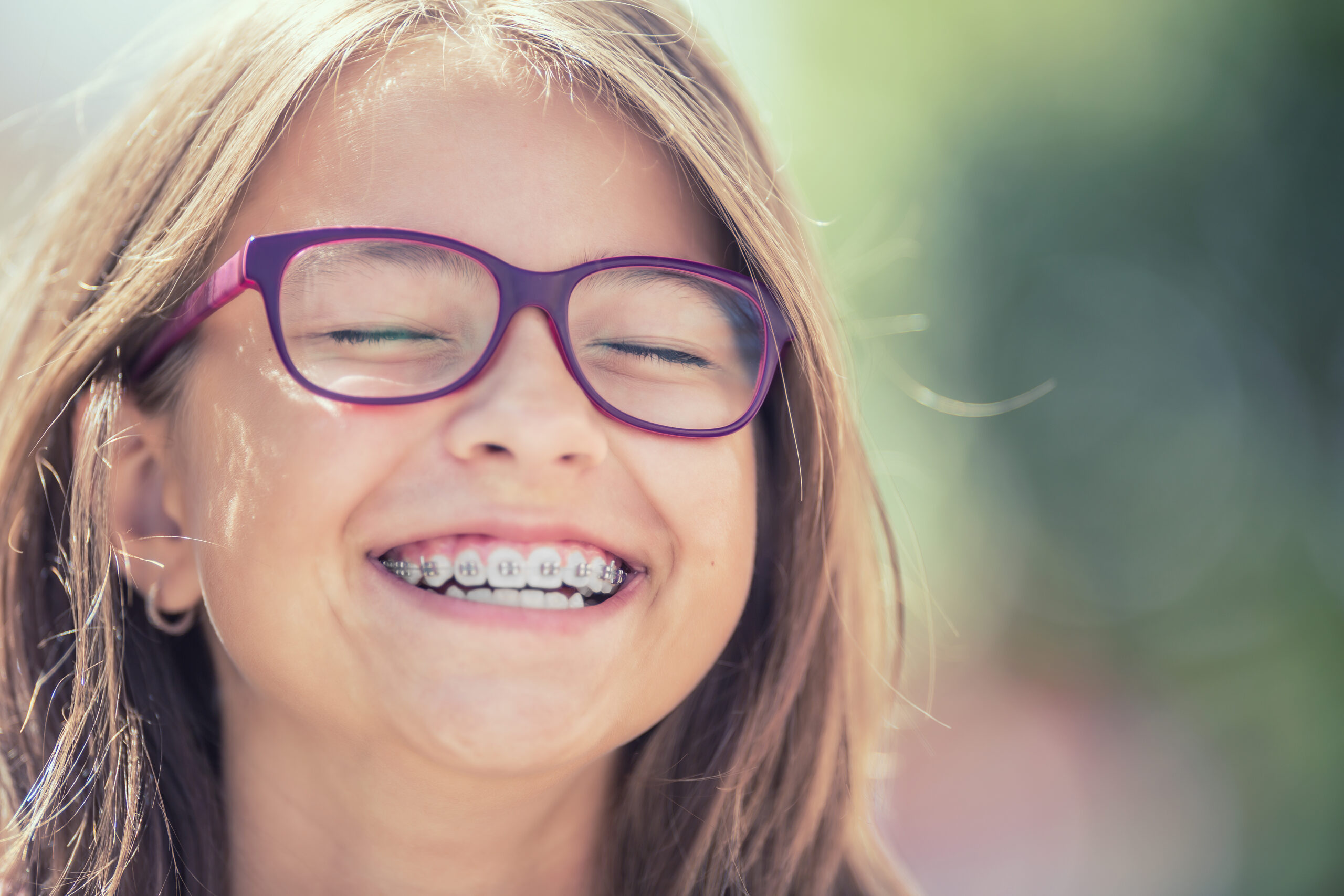 smile makeovers in Pleasanton